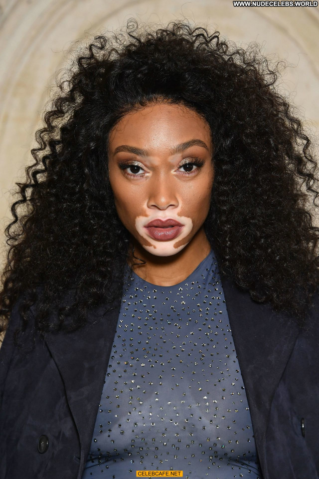 Winnie Harlow No Source Posing Hot Babe Celebrity See Through