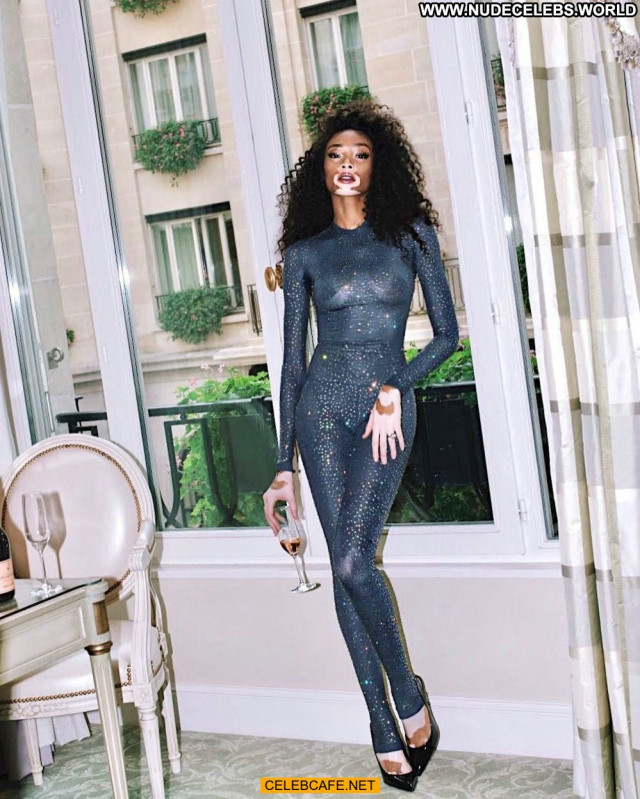 Winnie Harlow No Source See Through Beautiful Celebrity Posing Hot