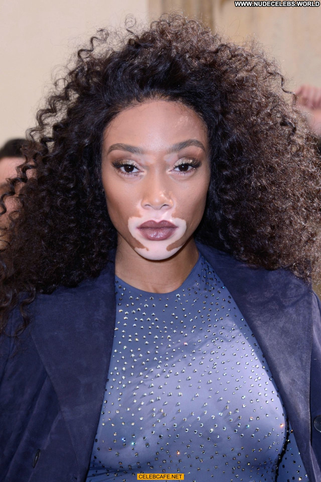 Winnie Harlow No Source Beautiful Posing Hot Babe Celebrity See