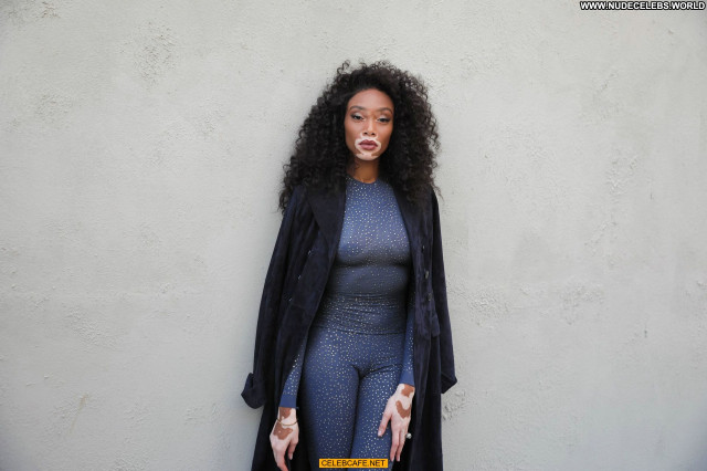Winnie Harlow No Source Posing Hot Babe Celebrity See Through