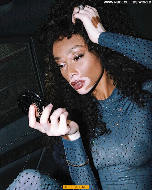 Winnie Harlow No Source Beautiful Celebrity See Through Babe Posing