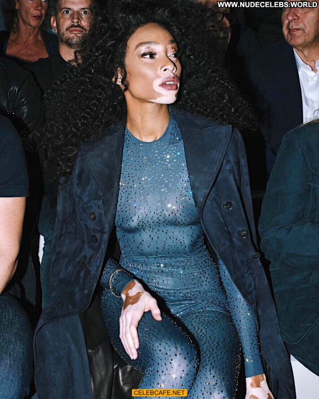 Winnie Harlow No Source Babe Beautiful Posing Hot Celebrity See