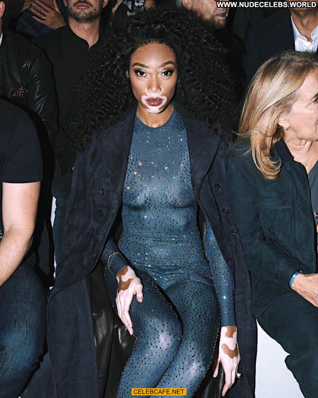 Winnie Harlow No Source See Through Beautiful Posing Hot Celebrity